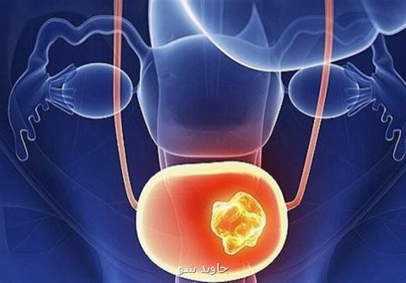 كاهش عفونت های جنسی در دوران شیوع ویروس كرونا