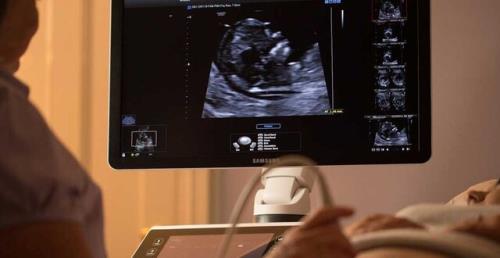 انجام سونوگرافی می تواند برای جنین مضر باشد؟